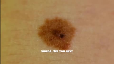 The Truth About Black Salve: Does It Really Work?