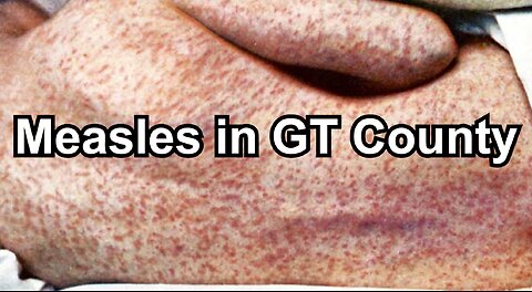 Measles in GT County
