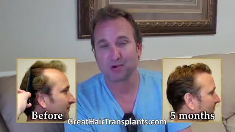 Dr. Brett Bolton Best Hair Transplant Surgeon in California - Sacramento - Promo