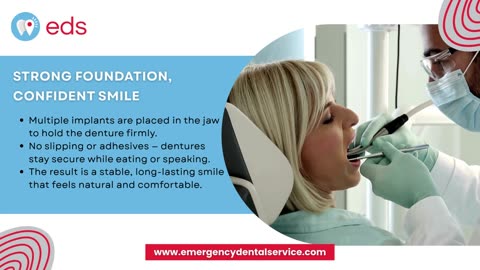 Full Denture Implants- A Complete Smile Transformation | Emergency Dental Service