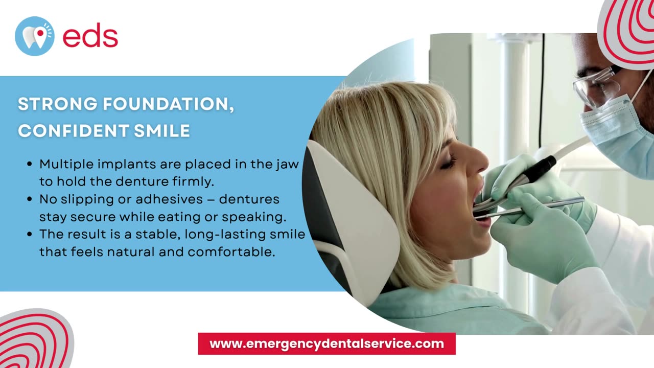 Full Denture Implants- A Complete Smile Transformation | Emergency Dental Service