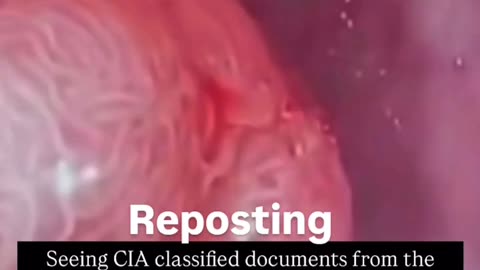 EVIDENCE 🔬 ~ TUMORs are PARASITEs 🦠 ‼️🌅🙌