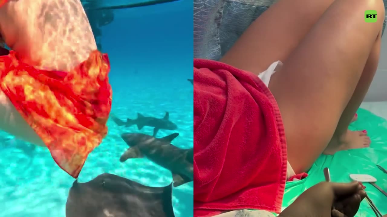 Tiburón muerde a turista en las Maldivas y casi le arranca la mano