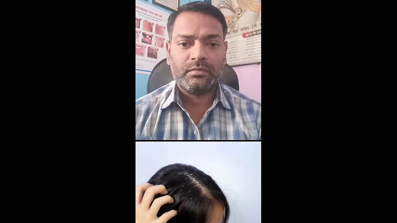 बालों का झड़ना और रूसी का इलाज ।