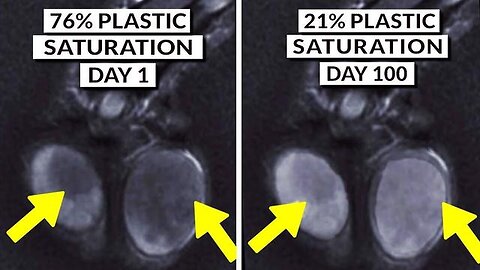 "Method to Detox Microplastics from Body Finally Discovered"