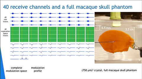 Recent Advances in the Neural Dust Platform - IEEE Brain Workshop 2018