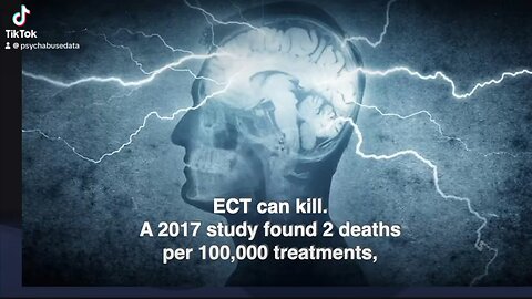 Electro-Convulsive “Therapy” is not “SAFE”!!!