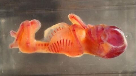 "Discovering the Link Between Aborted Fetal Cells and the Enhancement of Natural Flavor"