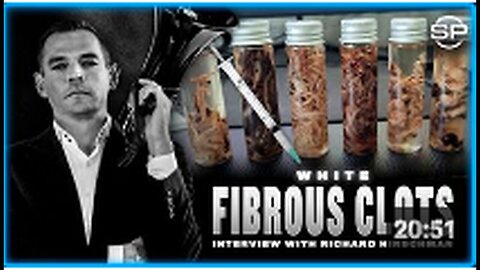Embalmers Continue Finding Fibrous Clots In Vaccinated Dead - Dying Suddenly Is Trend Media Ignores