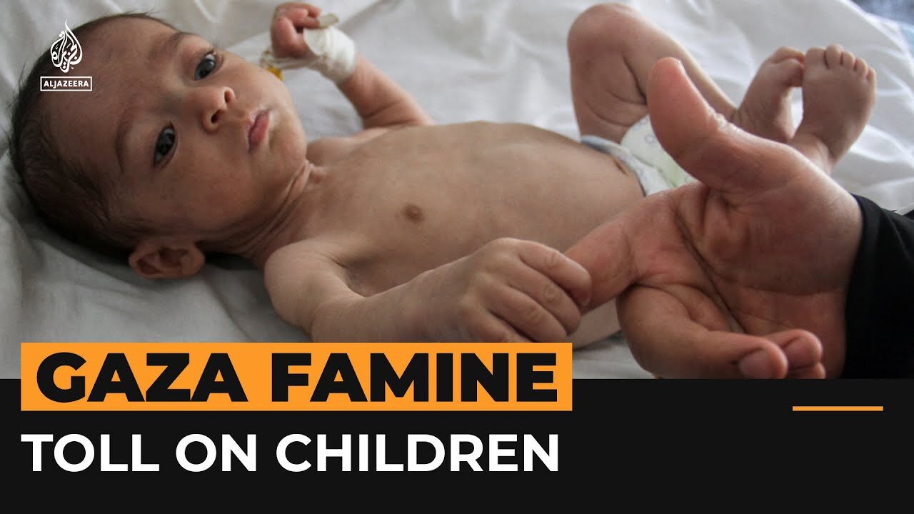 Gaza Famine Toll On Children