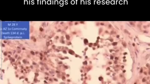 Spike proteins replacing sperm. Disturbing