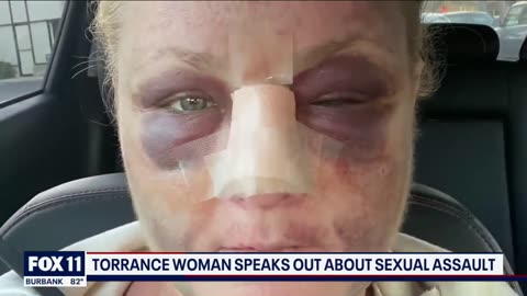 White woman sexually assaulted while walking her dogs by black sexual predator