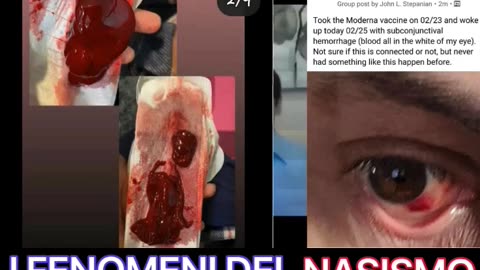 Se non lo capiscono così allora sono parecchio ritardati.
