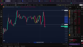 BITCOIN: $300M Liquidations Coming Soon! (warning) - BTC Price Prediction Today