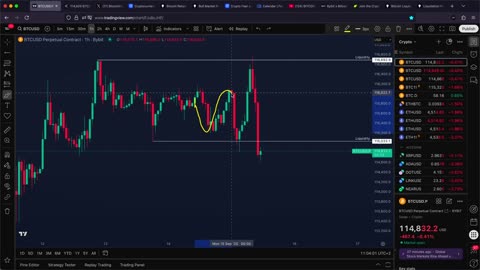 BITCOIN: $300M Liquidations Coming Soon! (warning) - BTC Price Prediction Today 