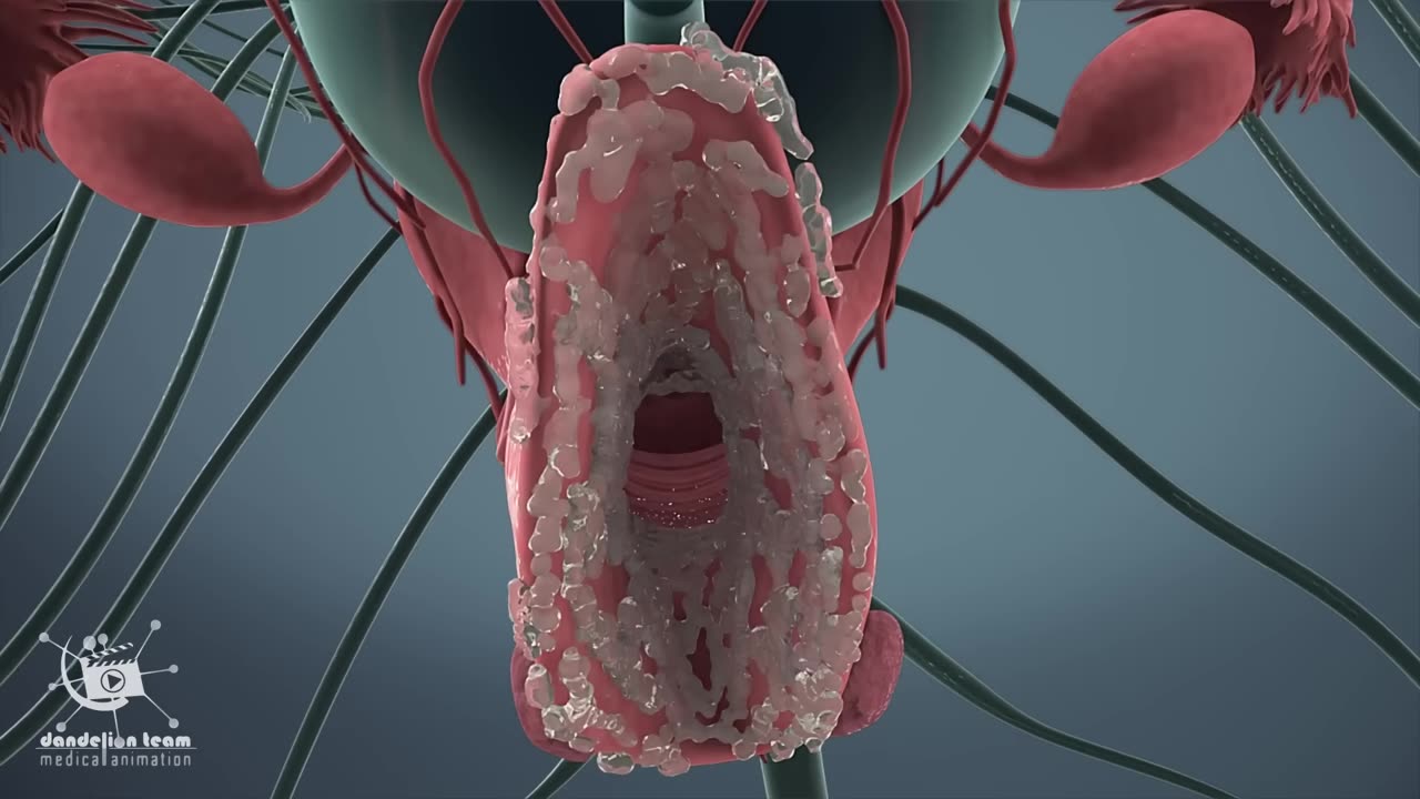 Menstruation and ovulation