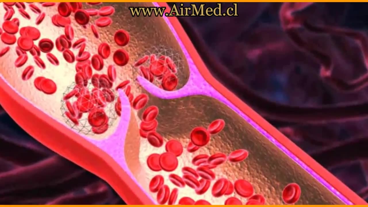 Diosmina y Hesperidina, ¿Para qué Sirve?