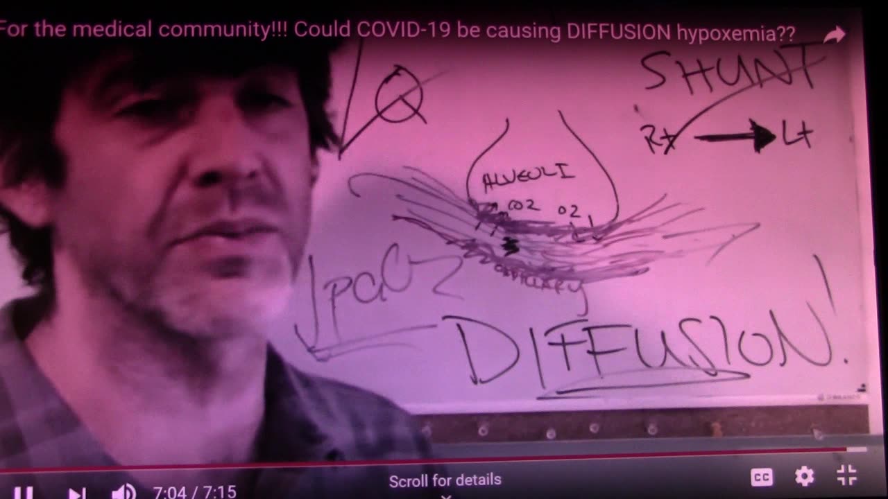 Dr Cameron Sidell NY Covid Hushed by Youtube
