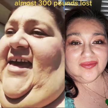 An amazing 300 pounds weight loss transformation