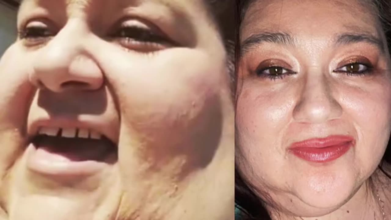 An amazing 300 pounds weight loss transformation