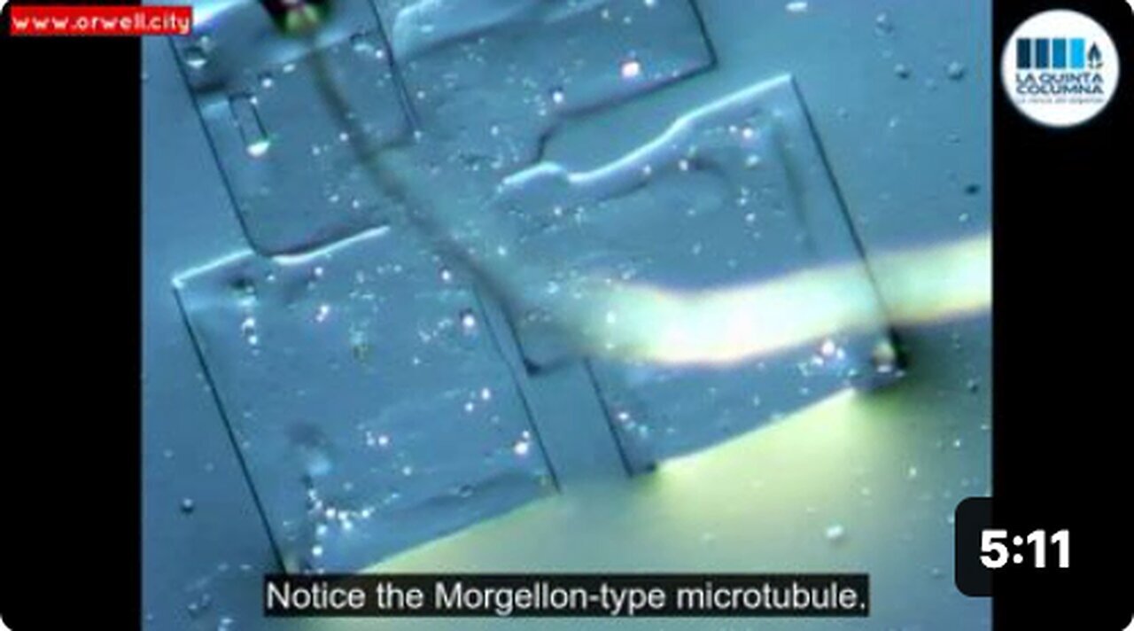 "Pfizer Vaccine's Microcircuitry: Fresh Images Revealed"