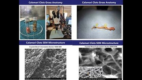 WHITE CLOT UPDATE ⚕ JOHN OLOONEY