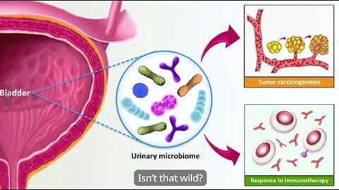 The Harmful Bacteria That Can Cause Sudden Urinary Leaks by Overstimulating Bladder Muscles