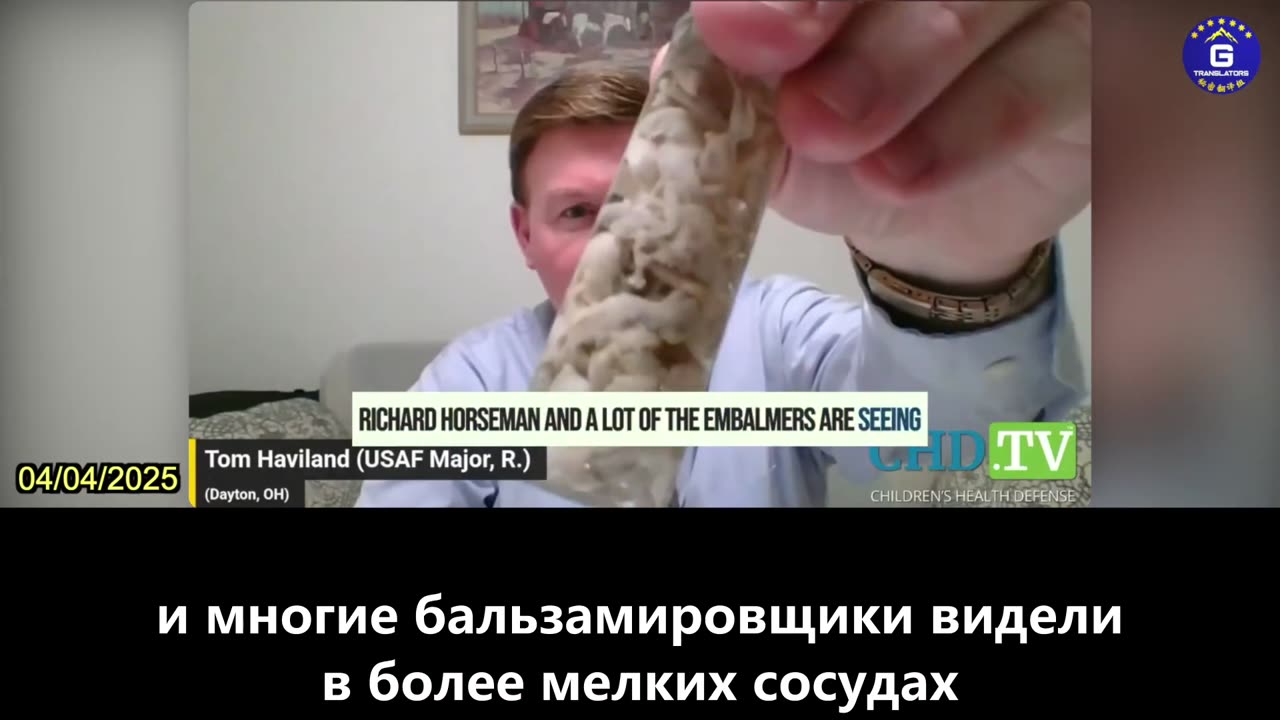 【RU】В 2024 году 83% бальзамировщиков увидят белые фиброзные сгустки крови у умерших