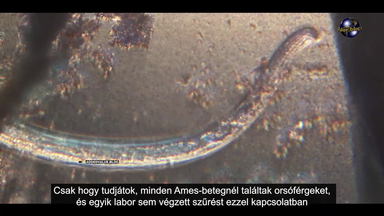 Paraziták - Dokumentumfilm