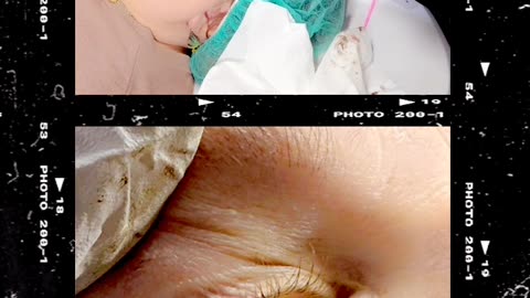 Perm Eyeliner Tattoo
