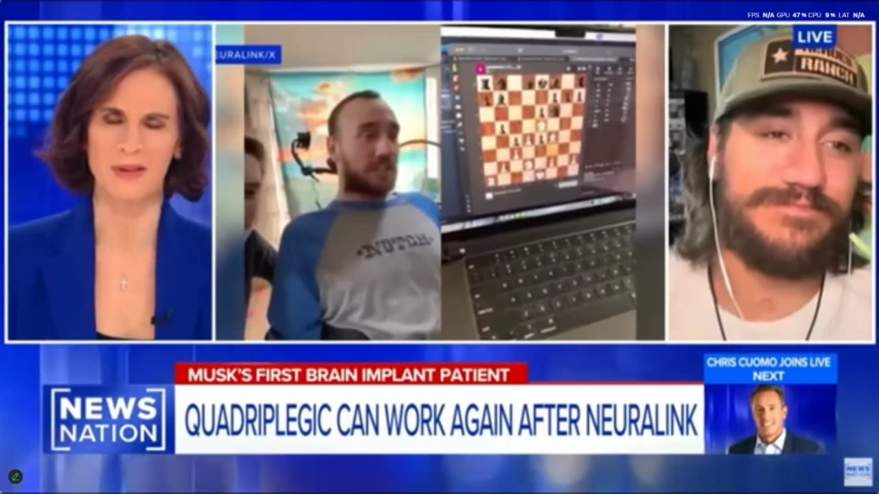 Charagma episode #151 (implants and miracles)