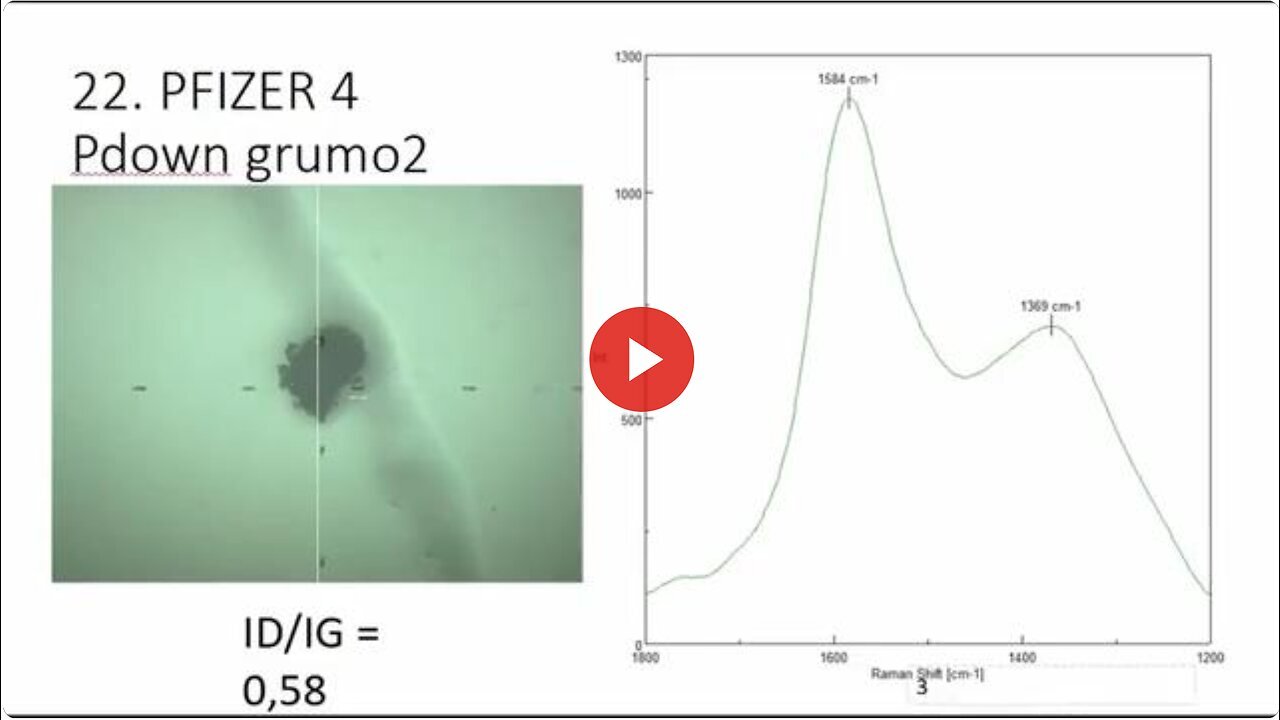 "Unveiling Dr. Pablo Campra's Study on Graphene Oxide in Covid-19 Vaccines"