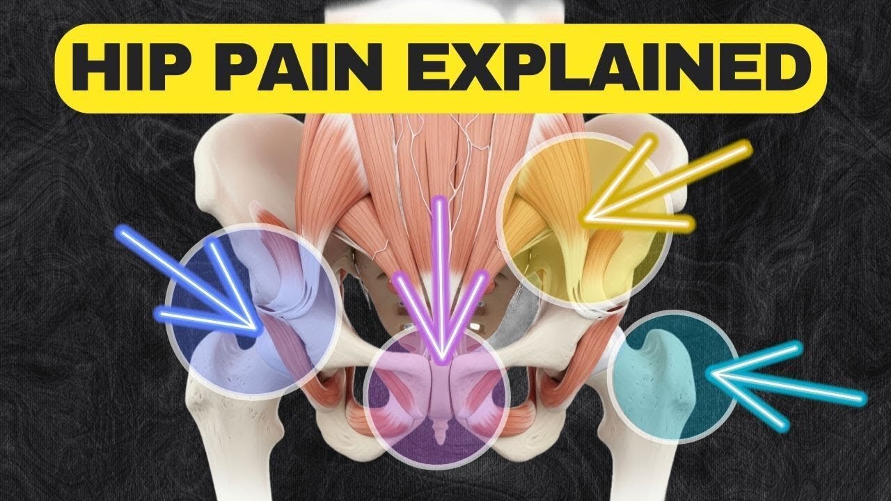 Why Your Hip Hurts (What Each Pain Location Means)