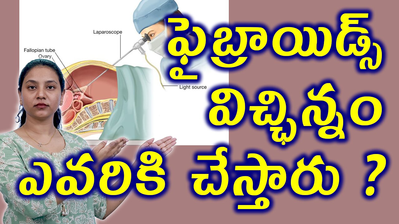 ఫైబ్రాయిడ్స్ విచ్ఛిన్నం ఎవరికి చేస్తారు Painless Faibroids Removal Surgery Laser Myolysis Conditions