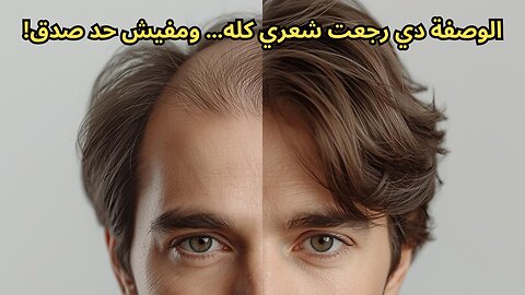 تجربتي مع ماء البصل للشعر: وصفة رهيبة لوقف تساقط الشعر وتكثيفه وملء الفراغات في أقل من شهر!