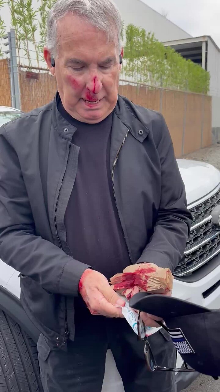 Security Guard Working With News Crew Attacked During Anti-ICE Protest in California