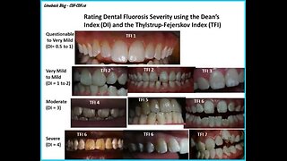 Fluoride poison in your water and yourself!