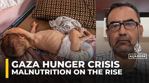 Babies in Gaza face irreversible harm from starvation and lack of aid, doctors warn