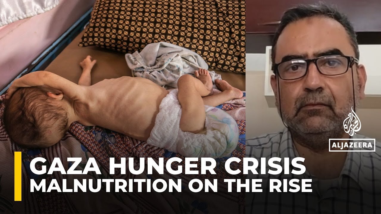 Babies in Gaza face irreversible harm from starvation and lack of aid, doctors warn