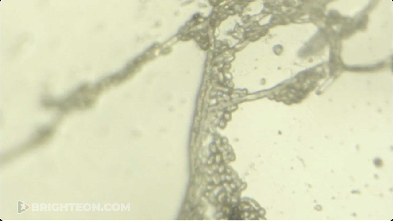 Strange Diploid Biological Masses Falling Out Of The Sky In Florida