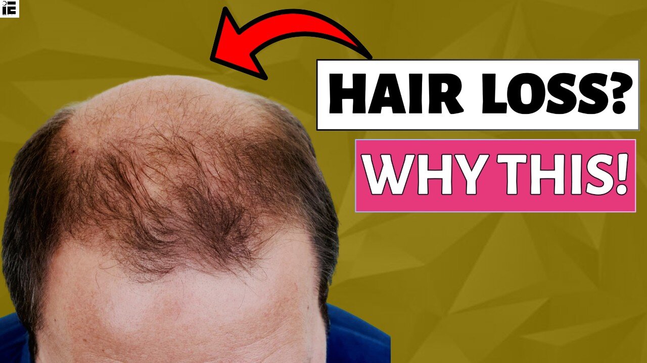 Root Causes why your hairline is RECEDING