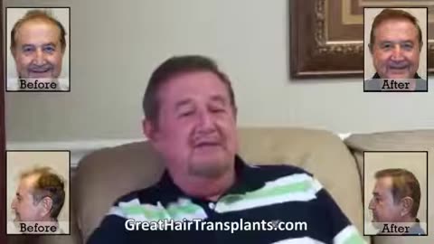 Dr. Brett Bolton Creates Another Remarkable Hair Restoration Outcome