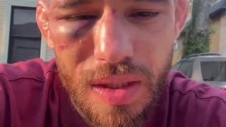 Jean Silva’s face the morning after his #NocheUFC defeat to Diego Lopes