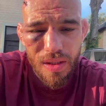 Jean Silva’s face the morning after his #NocheUFC defeat to Diego Lopes