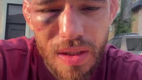 Jean Silva’s face the morning after his #NocheUFC defeat to Diego Lopes