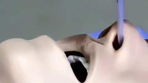 How NG Tube Insertion Procedure - Step by Step Medical Guide