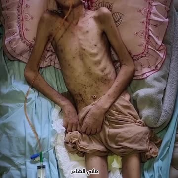 Obaida is facing death alone, with a body worn down by pain