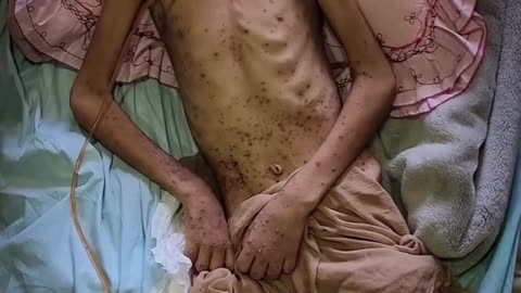Obaida is facing death alone, with a body worn down by pain