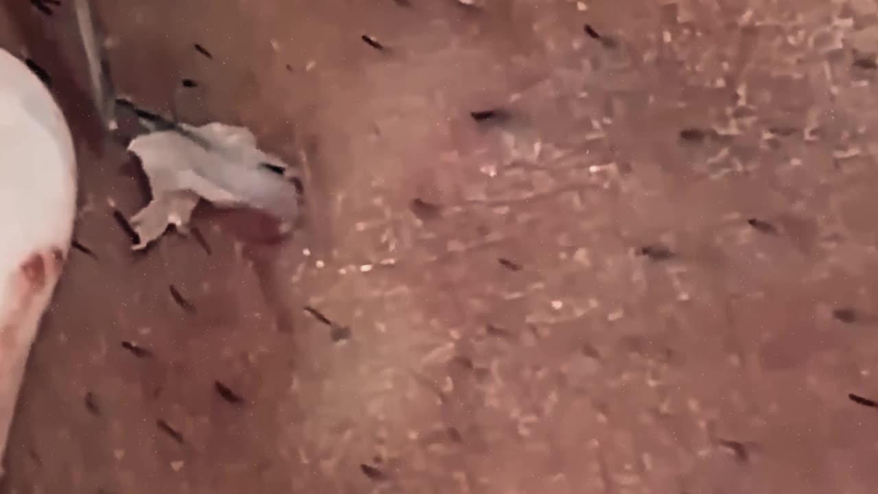 New satisfying blackhead removal #4