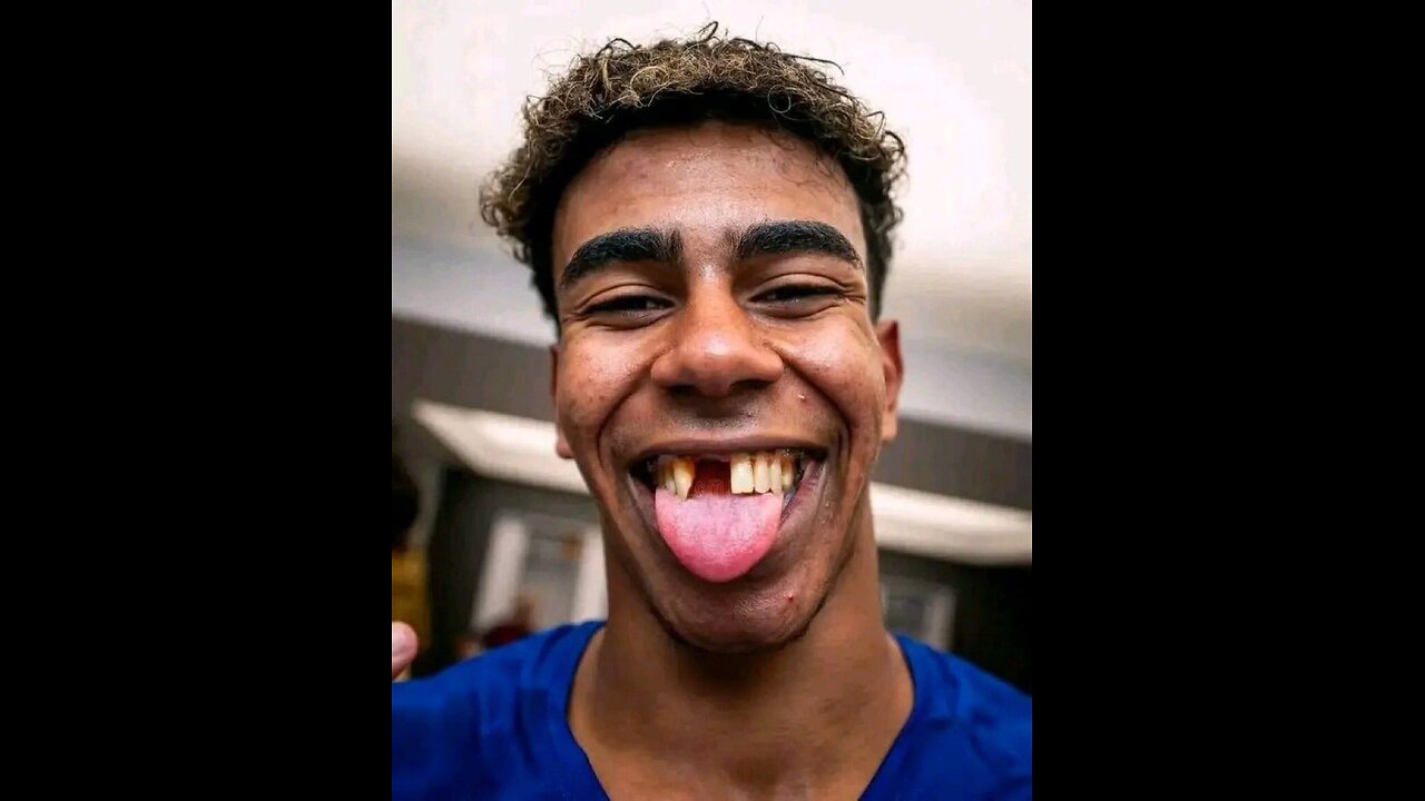 Vini striped balloon d' Or winning